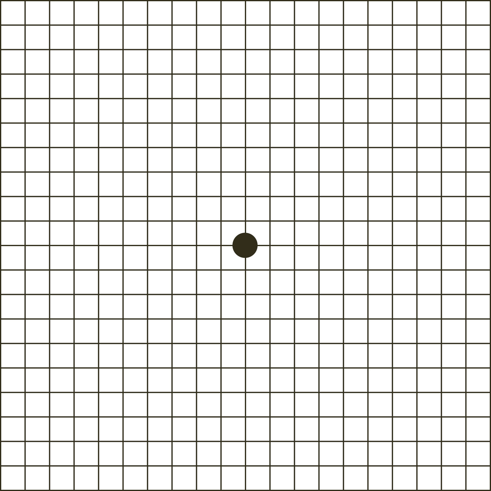 Amsler-Gitter mit Punkt in der Mitte – Selbsttest zur Wahrnehmung von Verzerrungen im Sehfeld (Hinweis auf AMD).